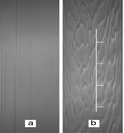 \includegraphics[width=11cm]{2acote.eps}